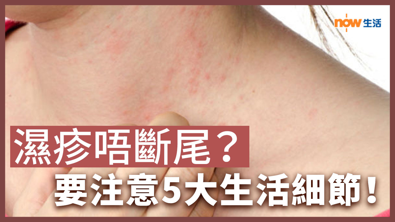 〈好Heal〉濕疹一直好不了?要注意5大生活細節!
