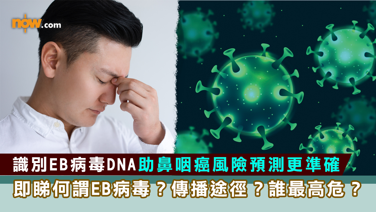 識別EB病毒DNA助鼻咽癌風險預測更準確　 即睇何謂EB病毒？傳播途徑？哪類人最高危？