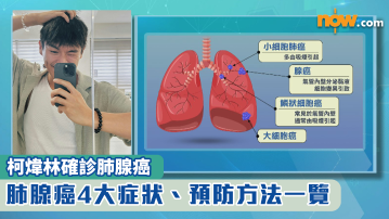 柯煒林確診肺腺癌｜肺腺癌4大症狀、預防方法一覽　非吸煙者確診個案上升