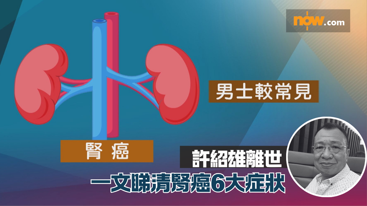許紹雄離世｜一文睇清腎癌6大症狀　肥胖、吸煙成最大元兇