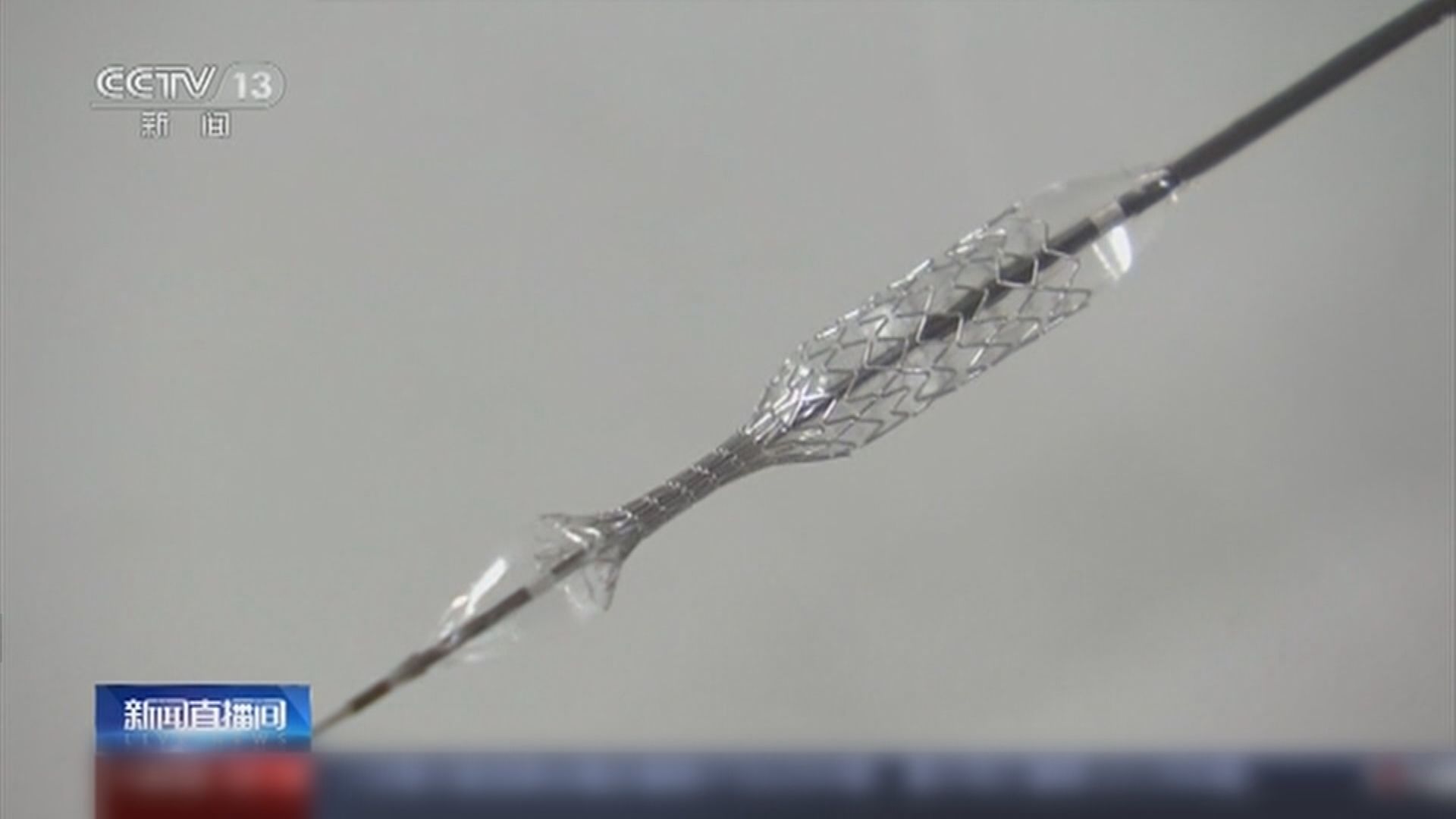 冠狀動脈支架中標價跌至不足千元