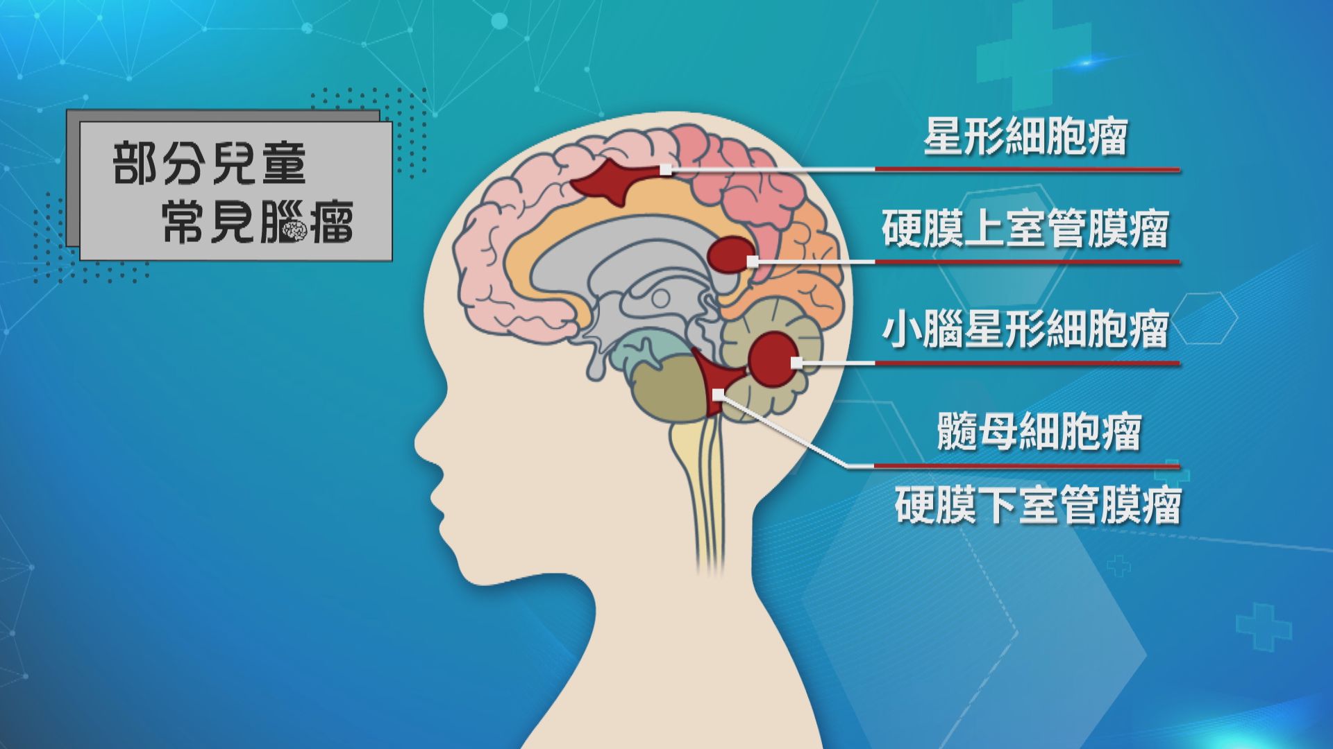 【杏林在線】右半身的挑戰