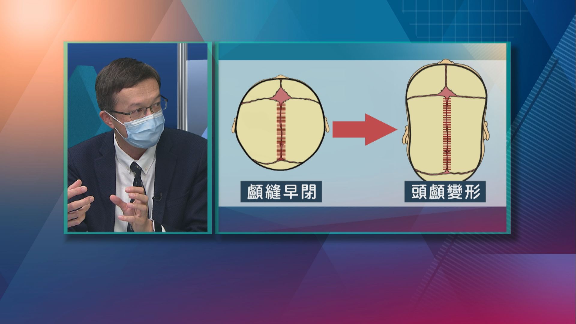【杏林在線】顱縫早閉