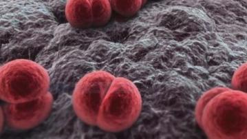 美英法三國近期發現12宗確感染腦膜炎雙球菌個案