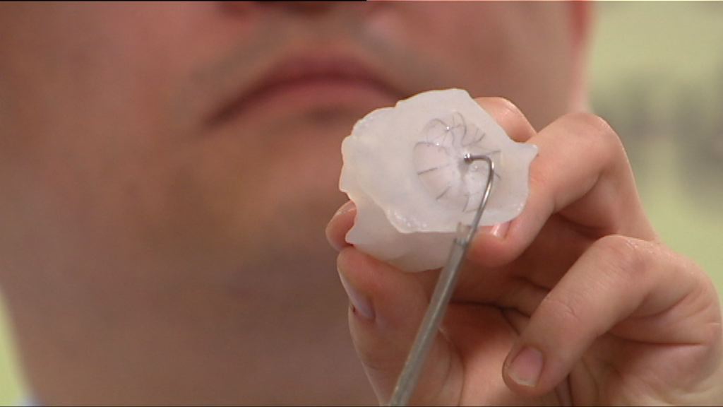 中大引入3D打印減心臟手術風險