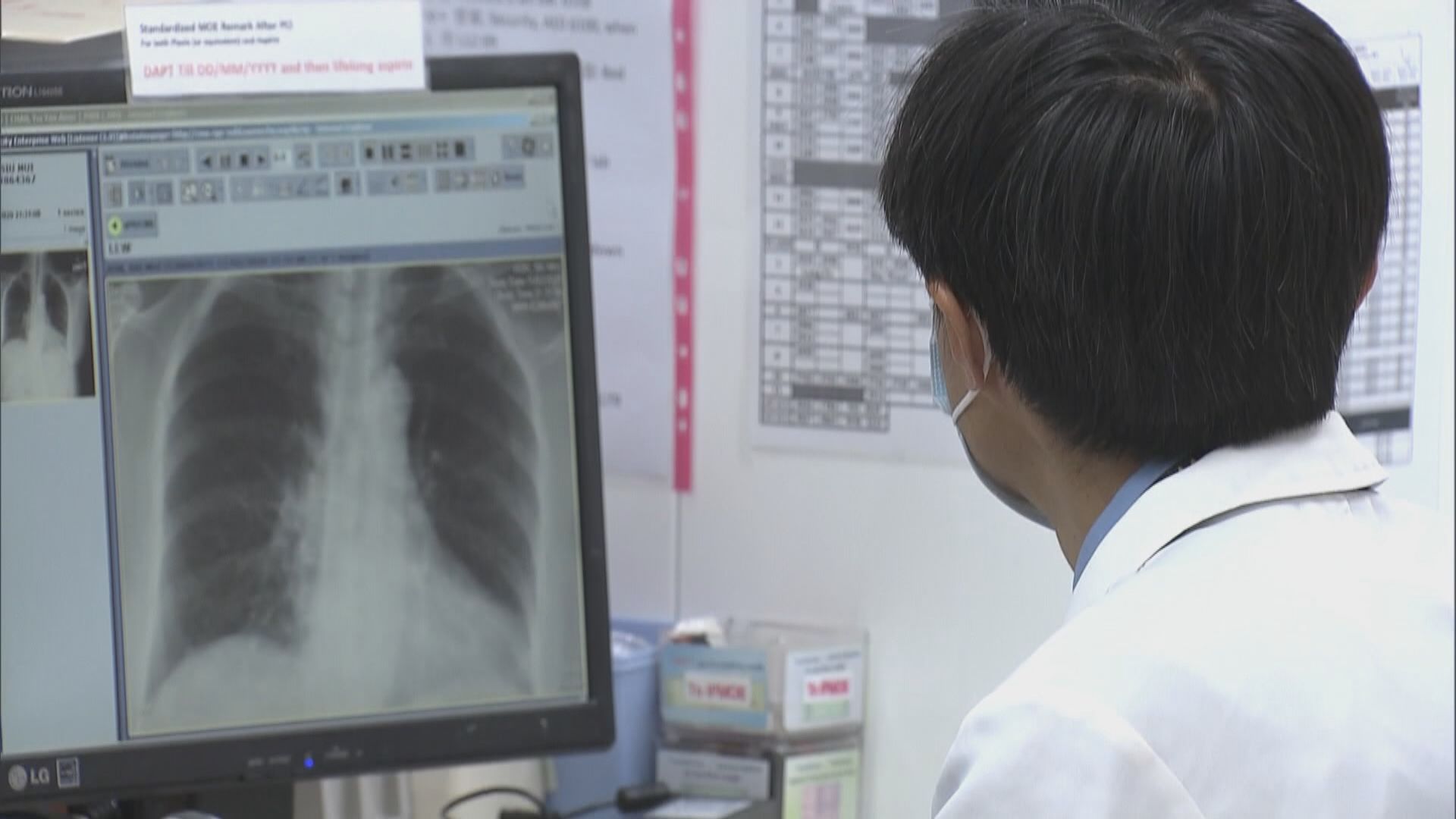 劉允怡：須設制度評核海外醫生在公營機構工作表現