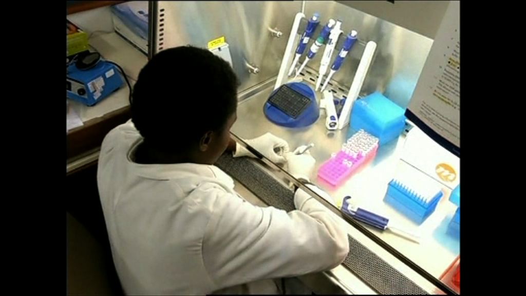 【環球薈報】根治愛滋病有重大突破