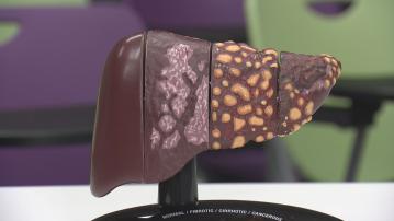 港大醫學院開展基因治療研究　冀根治乙型肝炎