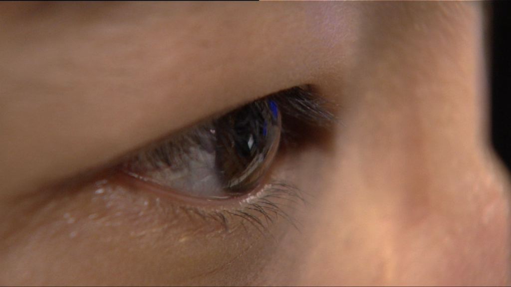 【杏林在線】糖尿上眼