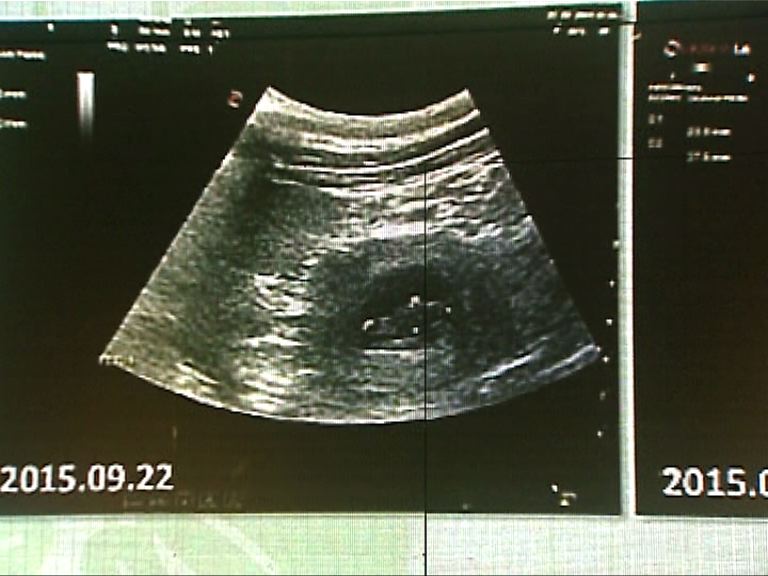 大熊貓盈盈懷孕料一周內分娩